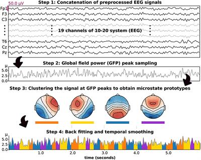 EEG Delta/Theta Ratio and Microstate Analysis Originating Novel Biomarkers for Malnutrition-Inflammation Complex Syndrome in ESRD Patients